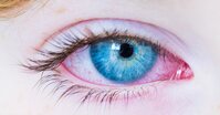 Antokyany pomáhají zmírňovat projevy digitální únavy očí